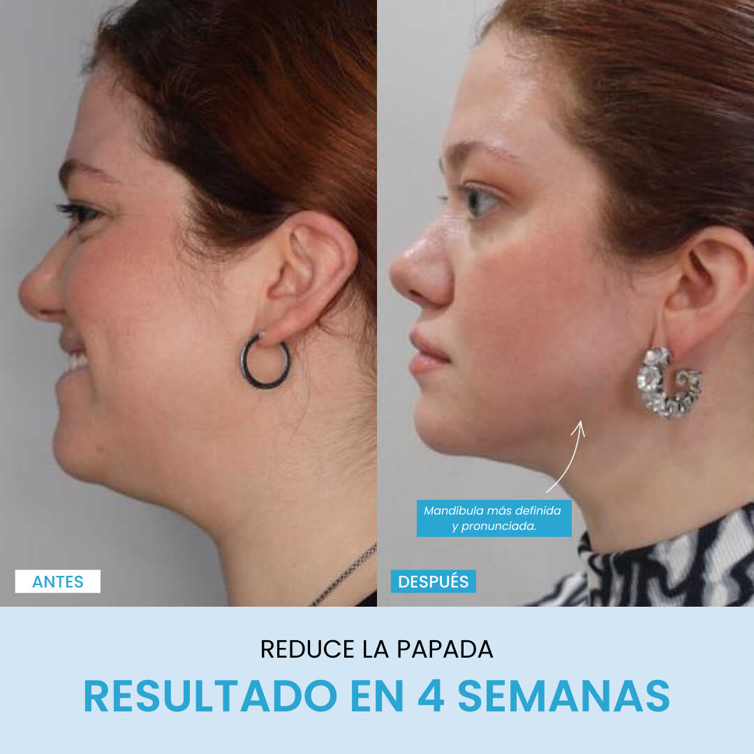 Liftlab Escultor + Sérum Gratis