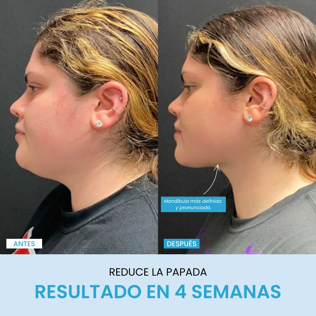 Liftlab Escultor + Sérum Gratis