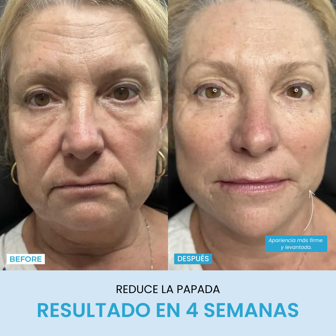 Liftlab Escultor + Sérum Gratis