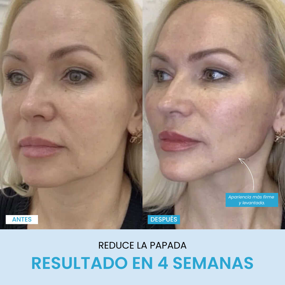 Liftlab Escultor + Sérum Gratis