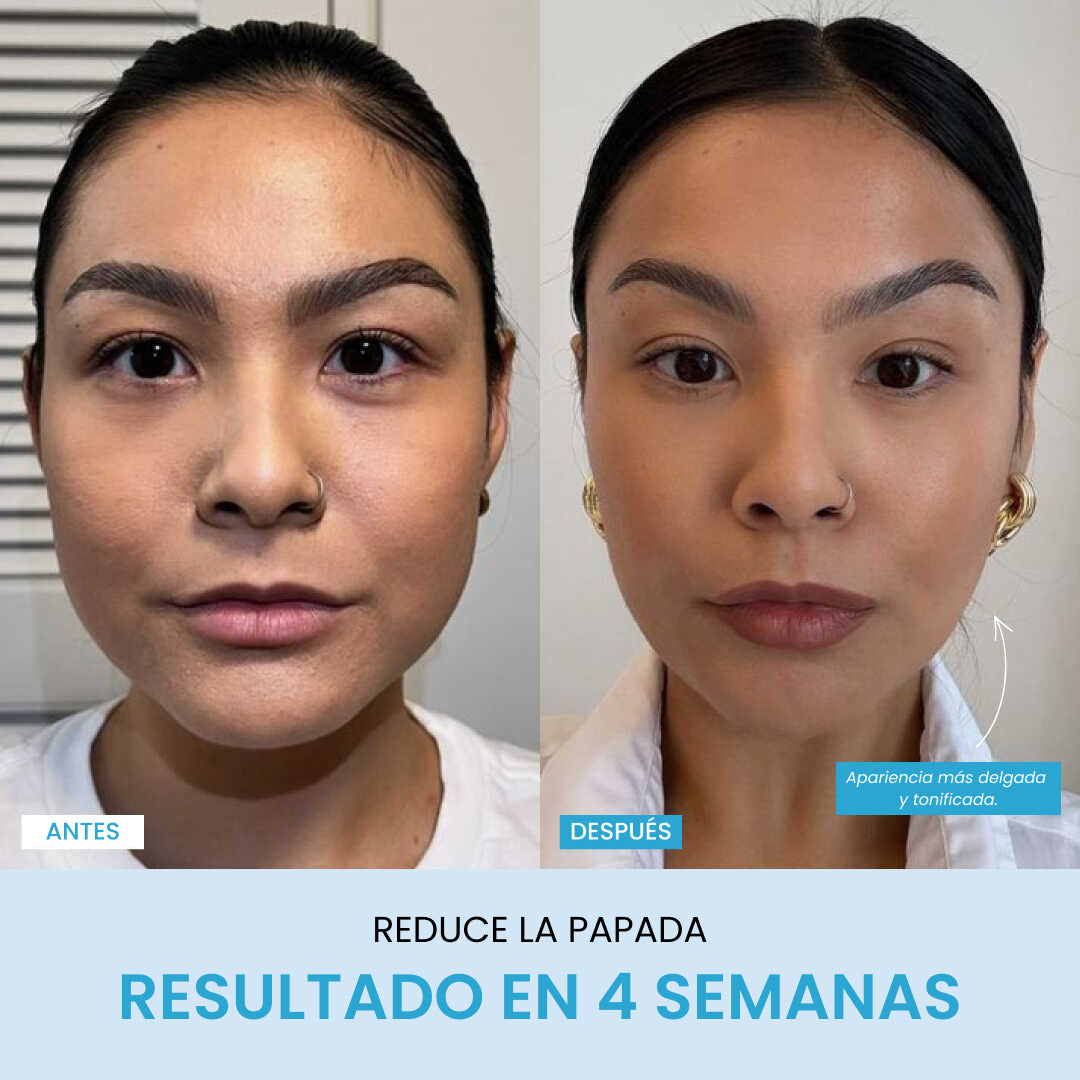 Liftlab Escultor + Sérum Gratis