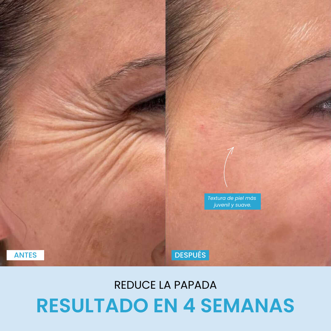 Liftlab Escultor + Sérum Gratis