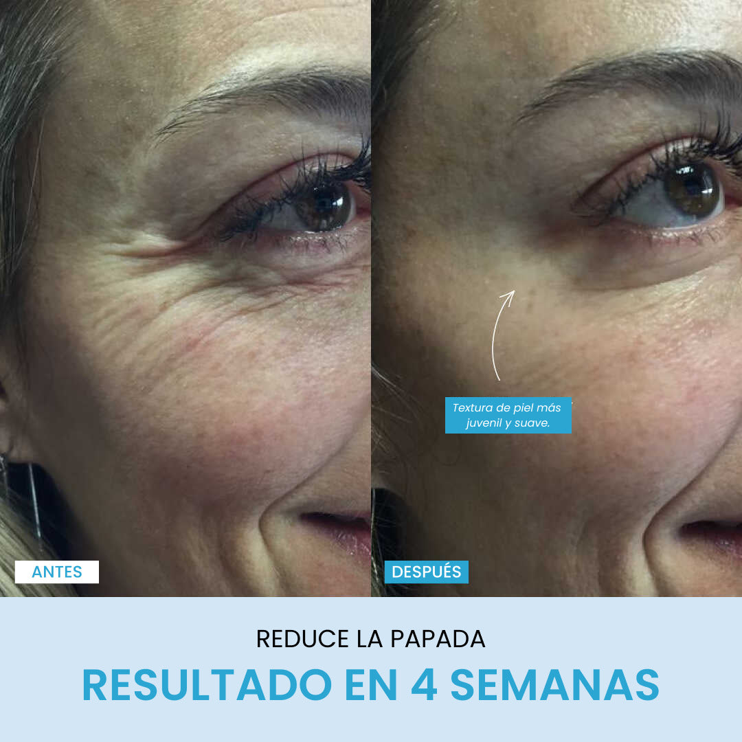 Liftlab Escultor + Sérum Gratis