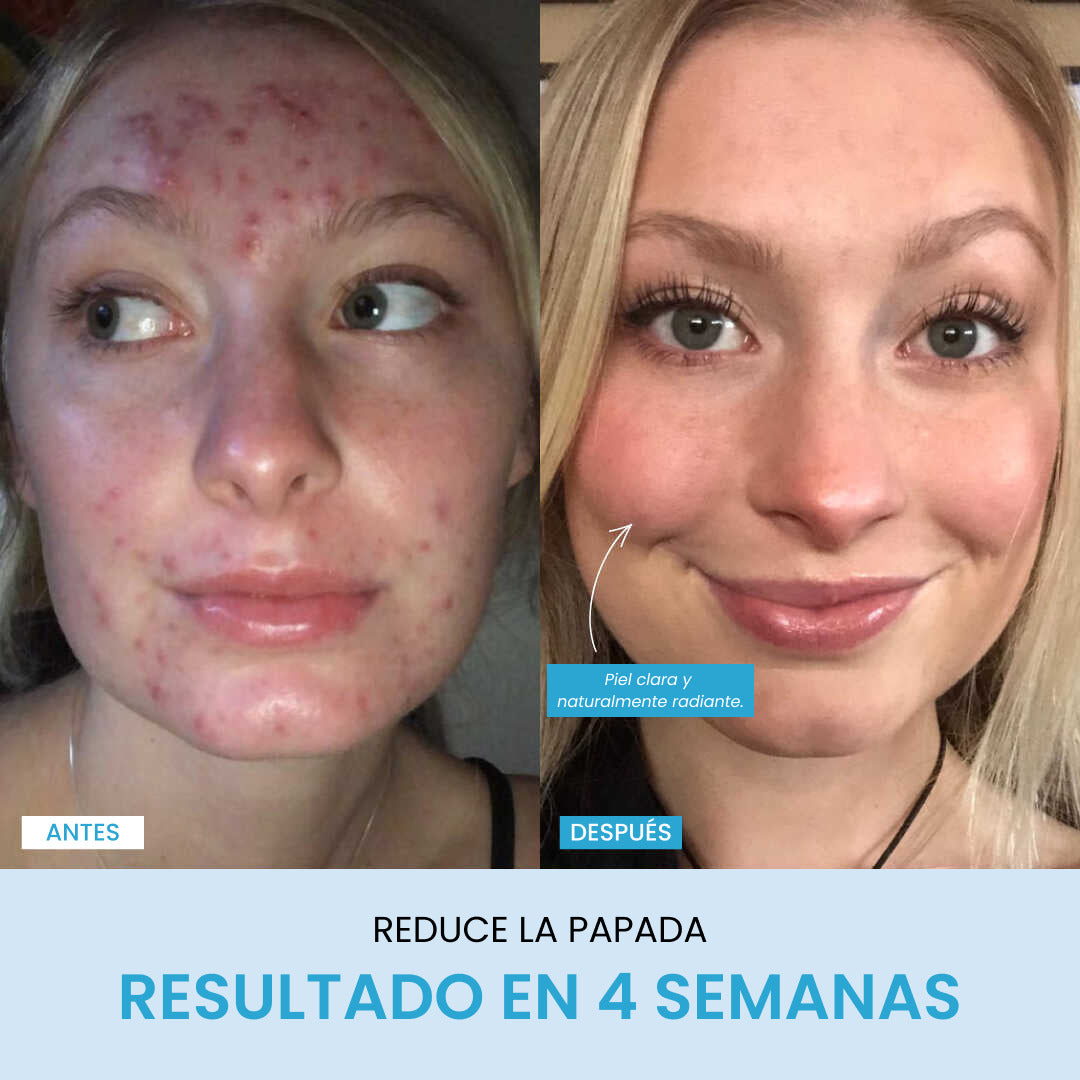 Liftlab Escultor + Sérum Gratis